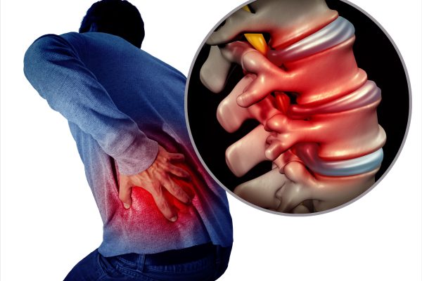 How to prevent lumbar disc herniation? Complete analysis of daily posture and exercise!