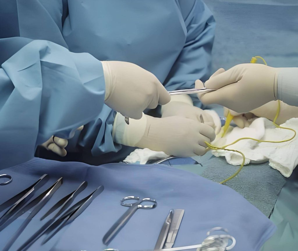 Complete Guide to Foreskin Reduction Surgery: From Preparation to Recovery